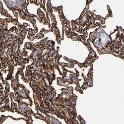 CD55/DAF Antibody, Novus Biologicals 25 &mu;L; Unlabeled:Antibodies, Polyclonal