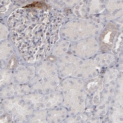 CD55/DAF Antibody, Novus Biologicals 25 &mu;L; Unlabeled:Antibodies, Polyclonal