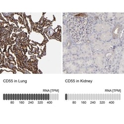 CD55/DAF Antibody, Novus Biologicals 25 &mu;L; Unlabeled:Antibodies, Polyclonal