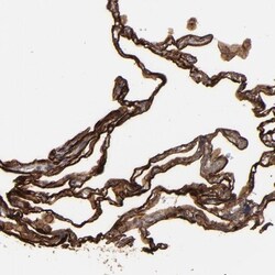CD55/DAF Antibody, Novus Biologicals 25 &mu;L; Unlabeled:Antibodies, Polyclonal