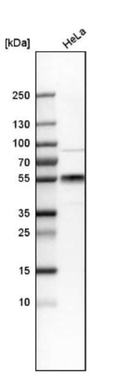 CD55/DAF Antibody, Novus Biologicals 25 &mu;L; Unlabeled:Antibodies, Polyclonal
