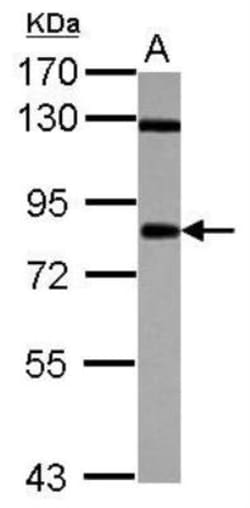 CD55/DAF Antibody, Novus Biologicals 0.1mL; Unlabeled:Antibodies, Polyclonal