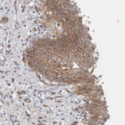 CD59 Antibody, Novus Biologicals:Antibodies:Primary Antibodies