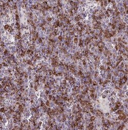 CD5L Antibody, Novus Biologicals:Antibodies:Primary Antibodies