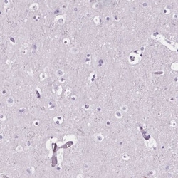 CD5L Antibody, Novus Biologicals:Antibodies:Primary Antibodies