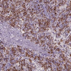 CD5L Antibody, Novus Biologicals:Antibodies:Primary Antibodies