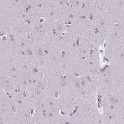 CD5L Antibody, Novus Biologicals:Antibodies:Primary Antibodies