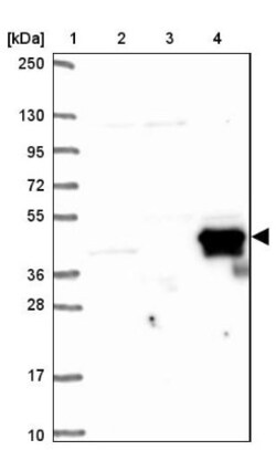 CD5L Antibody, Novus Biologicals:Antibodies:Primary Antibodies