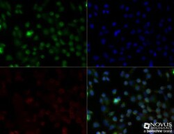 CD68/SR-D1 Antibody (FA-11) - BSA Free, Novus Biologicals 0.1mg; Unlabeled:Antibodies,