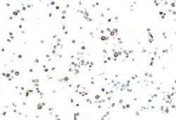 CD69 Antibody (BLR170J), Novus Biologicals 100 &mu;g | Buy Online | Novus Biologicals | Fisher Scientific