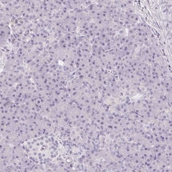 CD69 Antibody, Novus Biologicals 25 &mu;L, Unlabeled:Antibodies, Polyclonal