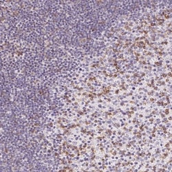 CD69 Antibody, Novus Biologicals 25 &mu;L, Unlabeled:Antibodies, Polyclonal