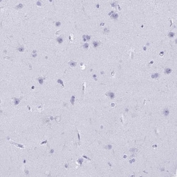 CD7 Antibody, Novus Biologicals 25 &mu;L, Unlabeled:Antibodies, Polyclonal