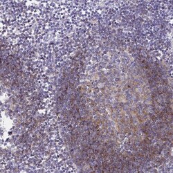 CD72 Antibody, Novus Biologicals 0.1mL; Unlabeled:Antibodies, Polyclonal