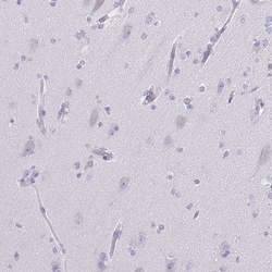 CD72 Antibody, Novus Biologicals 0.1mL; Unlabeled:Antibodies, Polyclonal