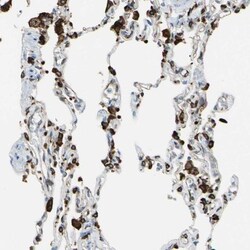 CD74 Antibody, Novus Biologicals 0.1mL; Unlabeled:Antibodies, Polyclonal