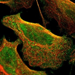 CD79B Antibody, Novus Biologicals 0.1mL; Unlabeled:Antibodies, Polyclonal