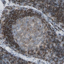 CD79B Antibody, Novus Biologicals 0.1mL; Unlabeled:Antibodies, Polyclonal