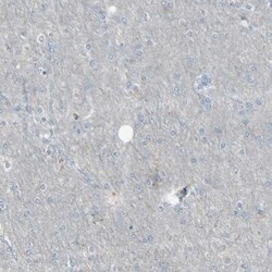 CD79B Antibody, Novus Biologicals 0.1mL; Unlabeled:Antibodies, Polyclonal