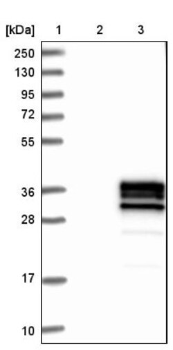 CD79B Antibody, Novus Biologicals 0.1mL; Unlabeled:Antibodies, Polyclonal