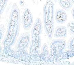 CD8 Antibody (BLR173J), Novus Biologicals 100 &mu;g | Buy Online | Novus Biologicals | Fisher Scientific