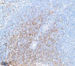 CD8 Antibody (BLR173J), Novus Biologicals 100 &mu;g | Buy Online | Novus Biologicals | Fisher Scientific