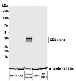 CD8 Antibody (BLR173J), Novus Biologicals 100 &mu;g | Buy Online | Novus Biologicals | Fisher Scientific
