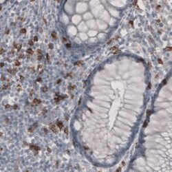 CD8 Antibody (CL1529), Novus Biologicals 0.1mL; Unlabeled:Antibodies, Monoclonal