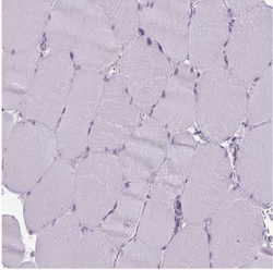 CD8 Antibody, Novus Biologicals:Antibodies:Primary Antibodies