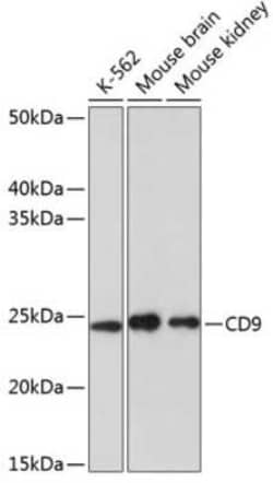 CD9 Rabbit anti-Human, Mouse, Clone: 10N2L6, Novus Biologicals:Antibodies:Primary