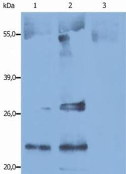 CD9 Antibody (IVA50) - BSA Free, Novus Biologicals 0.1mg; Unlabeled:Antibodies,