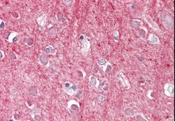 CD90/Thy1 Antibody, Novus Biologicals 0.1mg; Unlabeled:Antibodies, Polyclonal