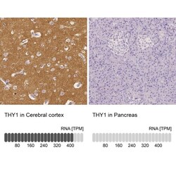CD90/Thy1 Antibody, Novus Biologicals 25 &mu;L; Unlabeled:Antibodies, Polyclonal