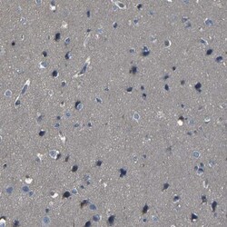 CD97 Antibody, Novus Biologicals 0.1mL; Unlabeled:Anticorps, Polyclonal