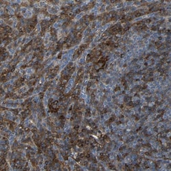CD97 Antibody, Novus Biologicals 0.1mL; Unlabeled:Anticorps, Polyclonal