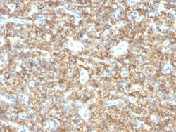 Mouse anti-CD99, Clone: HO36-1.1, Novus Biologicals 0.2mg; Unlabeled:Antibodies,