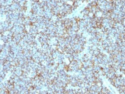 CD99 Antibody (MIC2/877), Novus Biologicals 0.2mg; Unlabeled:Antibodies,
