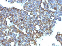 CD99 Antibody (MIC2/877), Novus Biologicals 0.2mg; Unlabeled:Antibodies,