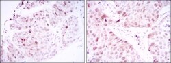CDC2/CDK1 Antibody (2G9), Novus Biologicals:Antibodies:Primary Antibodies