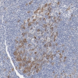 CDC2/CDK1 Antibody, Novus Biologicals:Antibodies:Primary Antibodies