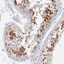 CDC2/CDK1 Antibody, Novus Biologicals:Antibodies:Primary Antibodies
