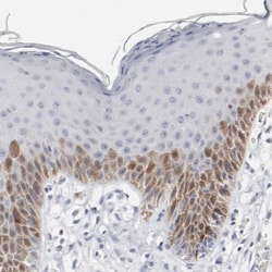 CDC2/CDK1 Antibody, Novus Biologicals:Antibodies:Primary Antibodies