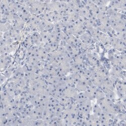 CDC2/CDK1 Antibody, Novus Biologicals:Antibodies:Primary Antibodies