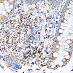 CDC25B Rabbit anti-Human, Clone: 4D5S10, Novus Biologicals 20 &mu;g; Unconjugated:Antibodies,