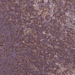 CDC25B Antibody, Novus Biologicals 0.1mL; Unlabeled:Antibodies, Polyclonal