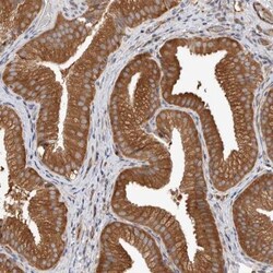 CDC42BPB Antibody, Novus Biologicals:Antibodies:Primary Antibodies