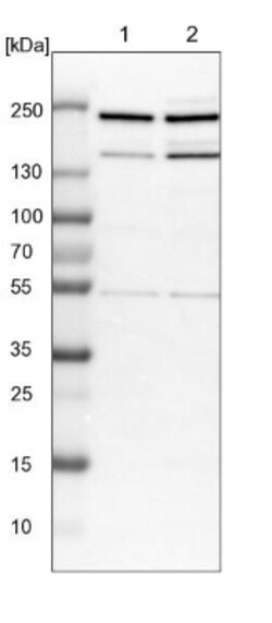 CDC42BPB Antibody, Novus Biologicals:Antibodies:Primary Antibodies