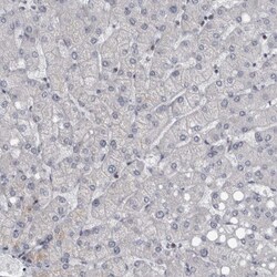 CDC42BPG Antibody, Novus Biologicals:Antibodies:Primary Antibodies
