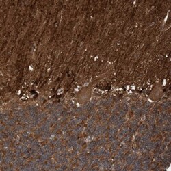 CDC42EP4 Antibody, Novus Biologicals:Antibodies:Primary Antibodies