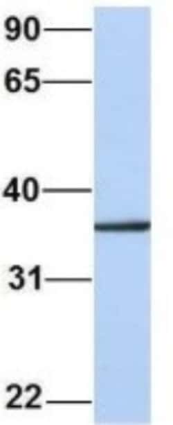 CDC42EP4 Antibody, Novus Biologicals 100 &mu;L | Buy Online | Novus Biologicals | Fisher Scientific